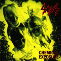 Sadus – Chemical Exposure